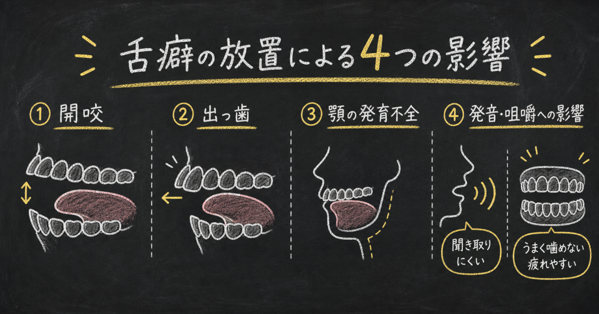 そもそも「舌癖（ぜつへき）」とは？無意識に行ってしまう代表的な種類と主な原因