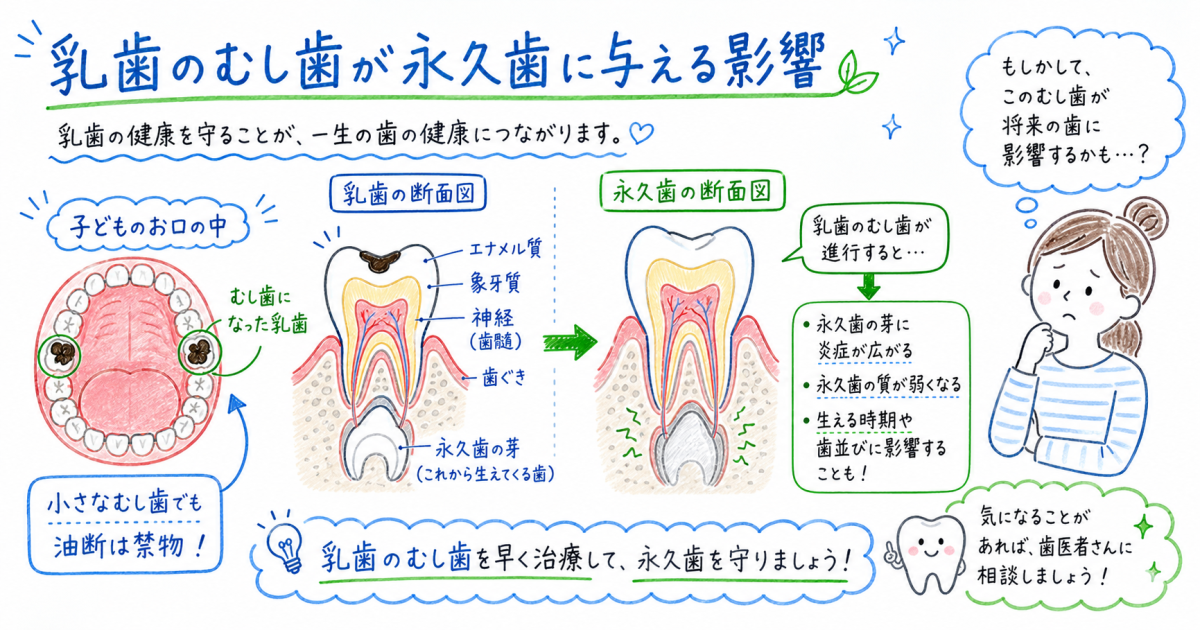 乳歯の虫歯で永久歯の歯並びがガタガタに？ママの不安に歯科医が回答