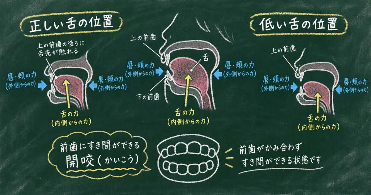 口呼吸や舌の癖は、子どもの歯並びにどう関わる？